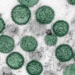 ¿Brote de hantavirus en un crucero puede convertirse en una epidemia? OMS responde