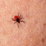Nuevo León registra aumento de 200% en casos de rickettsiosis durante 2026